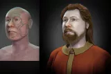 Z chirurgie do archeologie a zase zpět – nové možnosti 3D dokumentace napříč obory